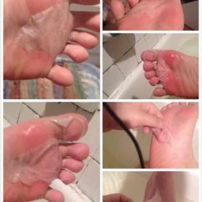 2pcs My style foot mask