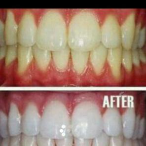 Activated Charcoal Powder Teeth Whitenin