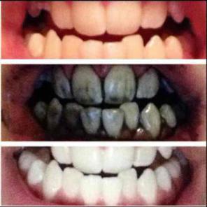 ✨✨✨✨✨5STAR! Organic Whitening Toothpaste