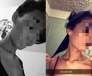 NATURAL HAIR GROWTH TREATMENT