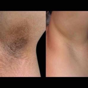 Dominican 1.4cm Clearing Cream