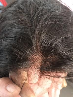 Alopecia Wig Full Handtied Handstitched