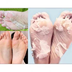 1- foot peeling &2- face mask