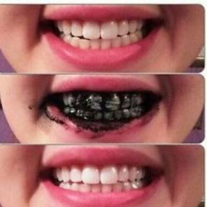 Removes stains from tooth enamel whitens