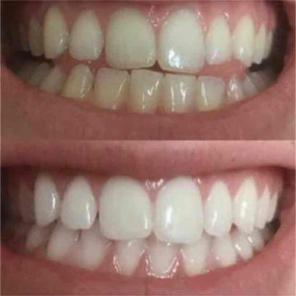 ORGANIC WHITENING KIT+ BAMBOO TOOTHBRUSH
