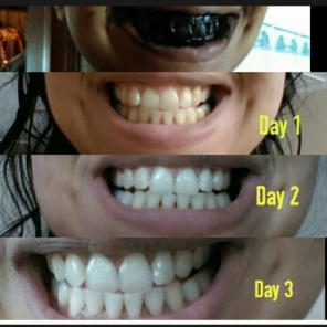 5 grams activated charcoal teeth whiteni