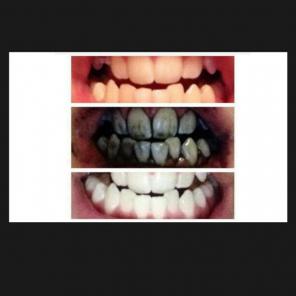 10 grams activated charcoal+toothbrush b