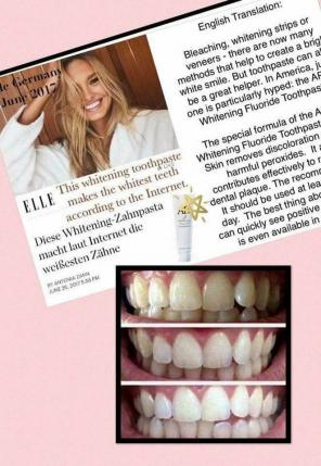 Blanqueamiento Dental