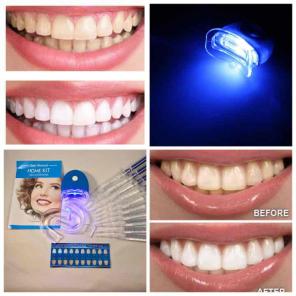 ✨COMPLETE TEETH WHITENING KIT W LIGHT✨