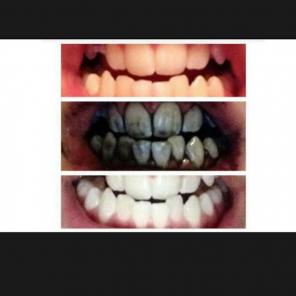5 grams activated charcoal+toothbrush be