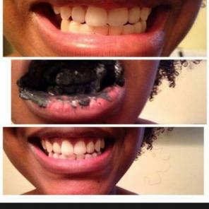 3 grams activated charcoal teeth whiteni