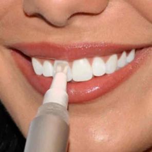 2x Pro strength teeth whitening pens
