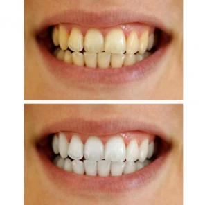 WHITENING TOOTHPASE & BAMBOO TOOTHBRUSH
